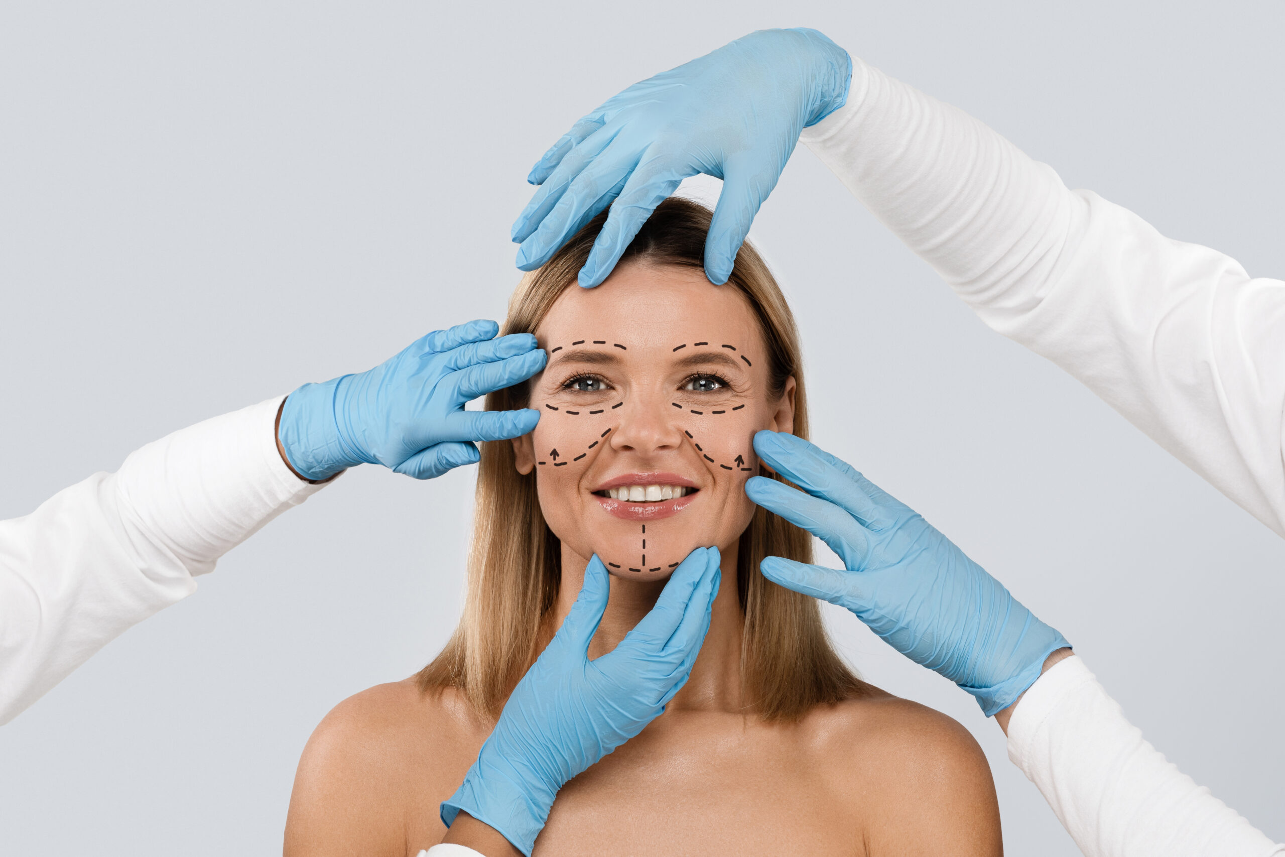 Smiling middle aged blonde woman with surgeon lines on face Smiling middle aged blonde woman with surgeon lines on face