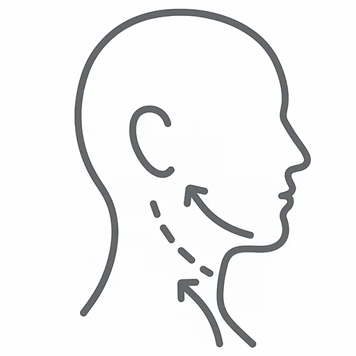 deep plane face lift diagram
