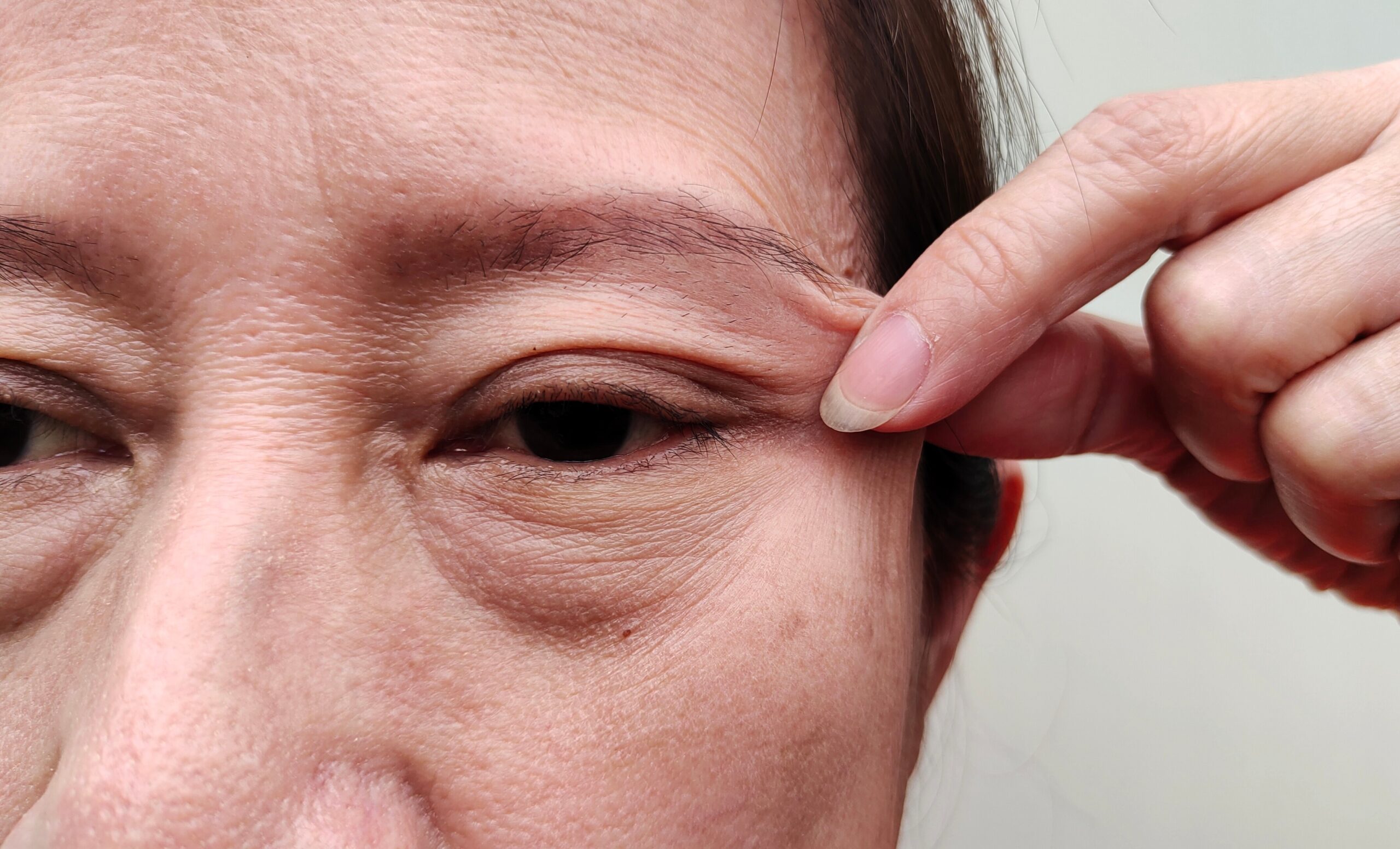 Portrait showing the fingers holding the flabbiness adipose sagging and ptosis beside the eyelid, Wrinkles and flabby skin under the eyes, problem dull skin and dark spots on the face of the woman. Portrait showing the fingers holding the flabbiness adipose sagging and ptosis beside the eyelid, Wrinkles and flabby skin under the eyes, problem dull skin and dark spots on the face of the woman.